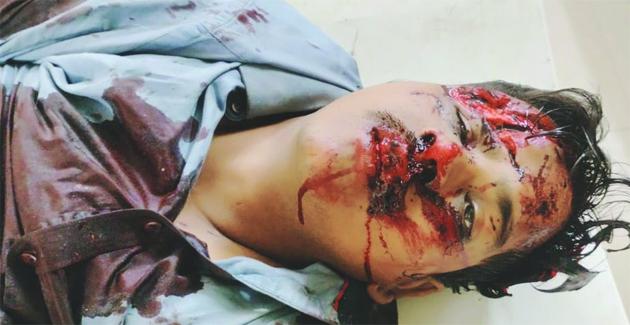 चावल लेकर लौट रहा युवक आया वाहन की चपेट में