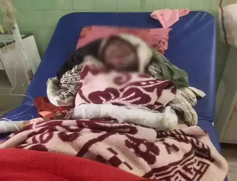 रिफिलिंग के दौरान फटा गैस सिलेंडर, नाबालिग झुलसा